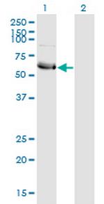 HSFY1 Monoclonal Antibody (1D2)