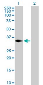 TRIM4 Antibody in Western Blot (WB)