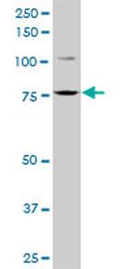 FCHSD1 Antibody in Western Blot (WB)