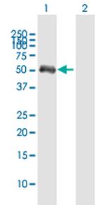 FCHSD1 Antibody in Western Blot (WB)
