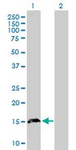 TPD52L3 Antibody in Western Blot (WB)