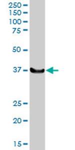 LHX4 Antibody in Western Blot (WB)