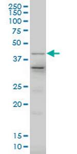 LHX4 Monoclonal Antibody (1D6)