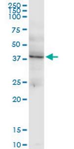 LHX4 Monoclonal Antibody (4F6)