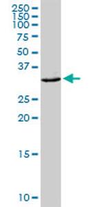 CEACAM21 Antibody in Western Blot (WB)