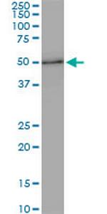 ZNF622 Monoclonal Antibody (4G6)