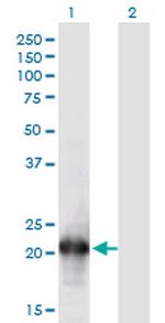 HN1L Monoclonal Antibody (1G8)