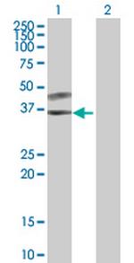 SPSB3 Polyclonal Antibody, MaxPab™