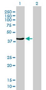 FMNL3 Antibody in Western Blot (WB)