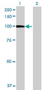 DKFZp434B1231 Antibody in Western Blot (WB)