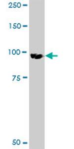 DKFZP434B1231 Antibody in Western Blot (WB)