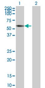ZNF502 Polyclonal Antibody, MaxPab™