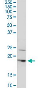 BTF3L4 Monoclonal Antibody (2G10)