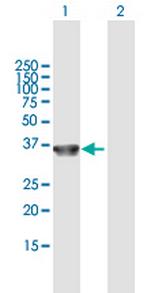 COL23A1 Polyclonal Antibody, MaxPab™