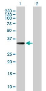 COL23A1 Polyclonal Antibody, MaxPab™
