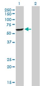DEPDC7 Polyclonal Antibody, MaxPab™