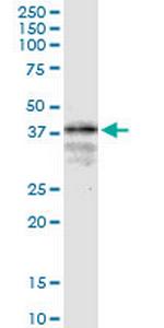LONRF1 Monoclonal Antibody (1D9)