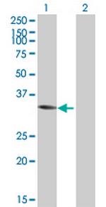 ACY3 Polyclonal Antibody, MaxPab™