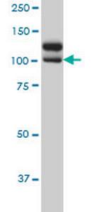 NEK9 Monoclonal Antibody (1F6)