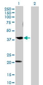 CABLES1 Antibody in Western Blot (WB)