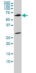 WDR20 Antibody in Western Blot (WB)