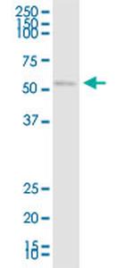 CHRDL1 Monoclonal Antibody (1D10)