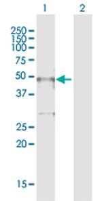 TTC5 Polyclonal Antibody, MaxPab™