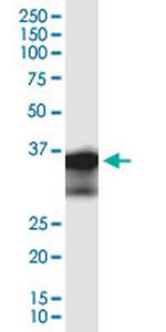 ZC3HAV1L Monoclonal Antibody (2D12)