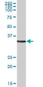 MRRF Antibody in Western Blot (WB)