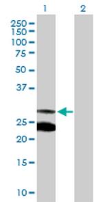MRRF Polyclonal Antibody, MaxPab™