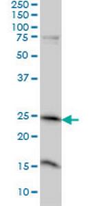 MRRF Antibody in Western Blot (WB)