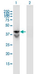 LDHAL6B Monoclonal Antibody (1C9)