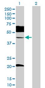 UBE2Q2 Antibody in Western Blot (WB)