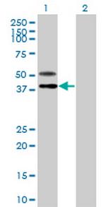 B3GNT7 Polyclonal Antibody, MaxPab™