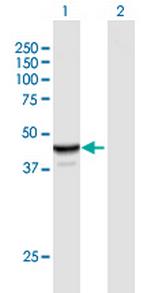 NAPRT1 Polyclonal Antibody, MaxPab™