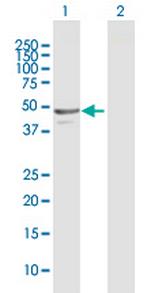 NAPRT1 Polyclonal Antibody, MaxPab™