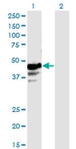 NAPRT1 Monoclonal Antibody (4A9)