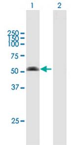 ARMC6 Antibody in Western Blot (WB)