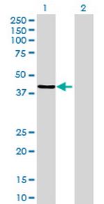 ZNF670 Polyclonal Antibody, MaxPab™