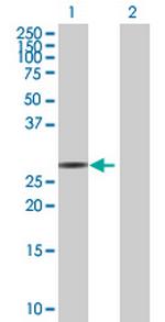 FBXO44 Polyclonal Antibody, MaxPab™
