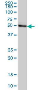 MGC21874 Antibody in Western Blot (WB)