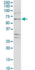 TJAP1 Monoclonal Antibody (2E5)