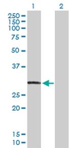 CAPZA3 Antibody in Western Blot (WB)