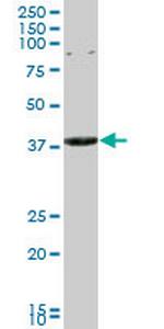 CAPZA3 Antibody in Western Blot (WB)