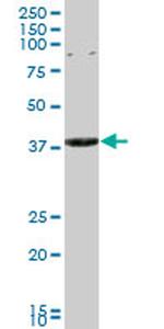 CAPZA3 Antibody in Western Blot (WB)