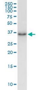 HTRA3 Monoclonal Antibody (1F2)