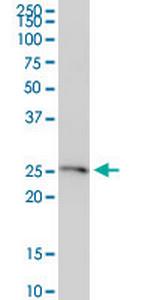FTMT Monoclonal Antibody (6G3)