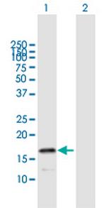 HSPB9 Polyclonal Antibody, MaxPab™