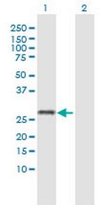TMEM203 Polyclonal Antibody, MaxPab™