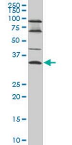 EPSTI1 Monoclonal Antibody (2A8)